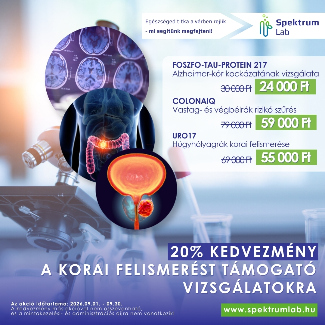 Három SpektrumLab vizsgálat 20 százalék kedvezménnyel 2026 szeptemberében